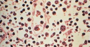 Tỷ lệ tử vong do nhiễm virus Hanta tăng cao, Chile nâng mức cảnh báo y tế