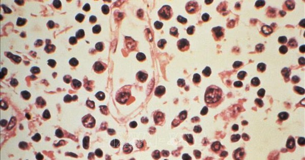 Tỷ lệ tử vong do nhiễm virus Hanta tăng cao, Chile nâng mức cảnh báo y tế