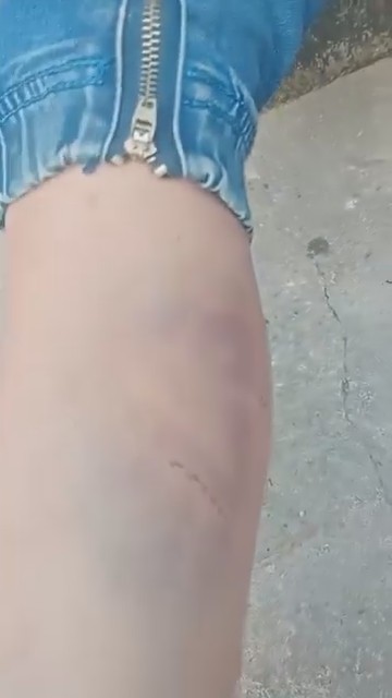 Bé trai nghi bị bạo hành ở Nghệ An được đưa đến cơ sở y tế thăm khám- Ảnh 1. Bé trai nghi bị bạo hành ở Nghệ An được đưa đến cơ sở y tế thăm khám- Ảnh 1.