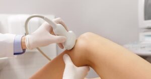 Dấu hiệu nhận biết rách sụn chêm khớp gối, cảnh giác khi chơi thể thao