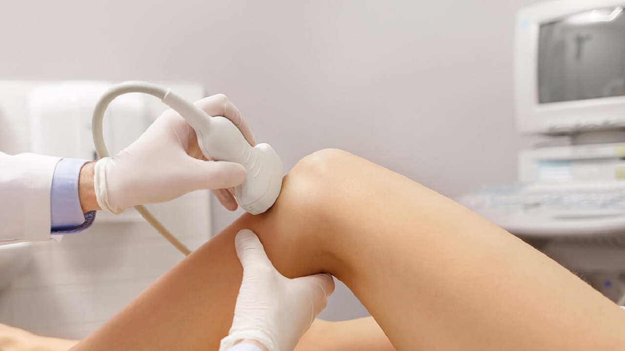 Dấu hiệu nhận biết rách sụn chêm khớp gối, cảnh giác khi chơi thể thao- Ảnh 1.