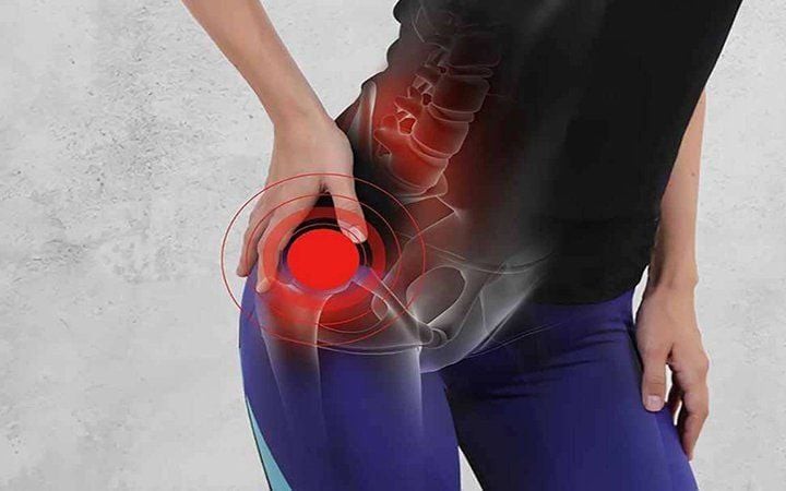 Triệu chứng chấn thương khớp háng sau khi vận động mạnh- Ảnh 2.