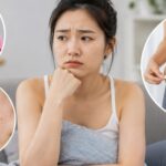 Dấu hiệu buồng trứng đa nang dễ bị bỏ qua