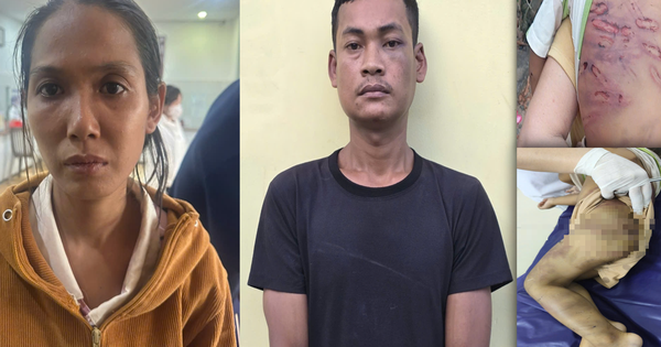Bắt khẩn cấp mẹ ruột và ‘cha dượng’ bạo hành bé trai 2 tuổi tại TPHCM
