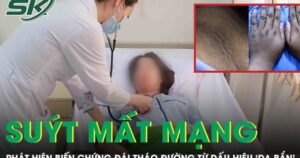 Tưởng da bẩn, cô gái 20 tuổi suýt mất mạng vì biến chứng đái tháo đường