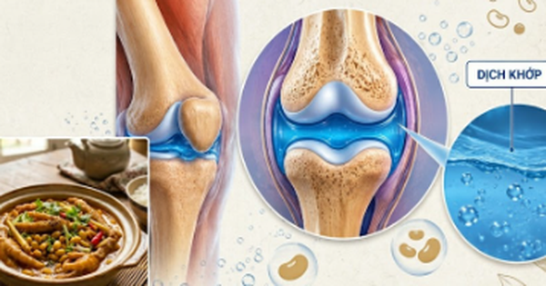 3 món ăn giúp ‘bôi trơn’ khớp gối cho người trung niên và cao tuổi