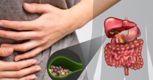 Bệnh sỏi túi mật phổ biến nhưng thường bị xem nhẹ, cảnh báo biến chứng nặng