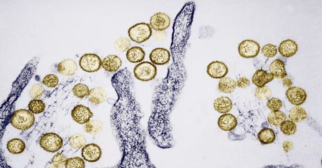 Hantavirus khiến 3 người trên du thuyền MV Hondius tử vong nguy hiểm ra sao?
