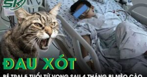 Đau xót: Bé trai 5 tuổi tử vong sau 4 tháng bị mèo cào