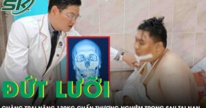 Cứu chàng trai nặng 130 kg đứt lưỡi sau tai nạn giao thông