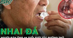 Nhai đá giải nhiệt, người đàn ông 66 tuổi suýt tắc đường thở
