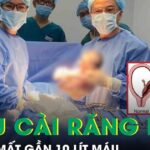 Thai phụ 36 tuần mất gần 10 lít máu, nguy hiểm tính mạng vì tai biến nhau cài răng lược