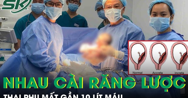Thai phụ 36 tuần mất gần 10 lít máu, nguy hiểm tính mạng vì tai biến nhau cài răng lược