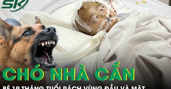 Chó nhà cắn, bé 19 tháng tuổi rách sâu vùng đầu và mặt phải cấp cứu