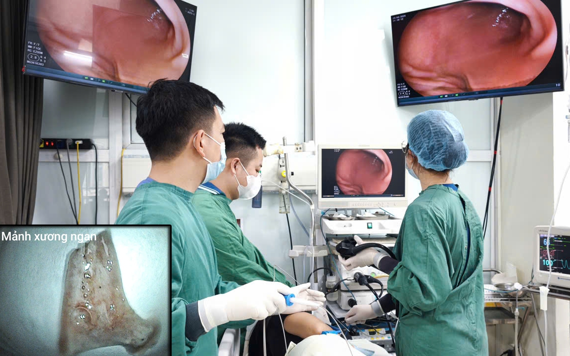 Hi hữu hóc lông lợn sau khi ăn bánh mỳ pate- Ảnh 4.