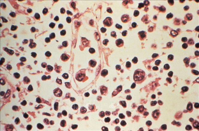 Tỷ lệ tử vong do nhiễm virus Hanta tăng cao, Chile nâng mức cảnh báo y tế- Ảnh 1.