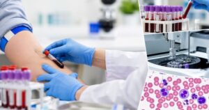 Những xét nghiệm cơ bản ai cũng nên làm