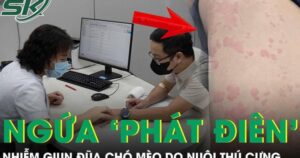 Ngứa ‘phát điên’, người đàn ông đi khám phát hiện nhiễm giun đũa chó mèo