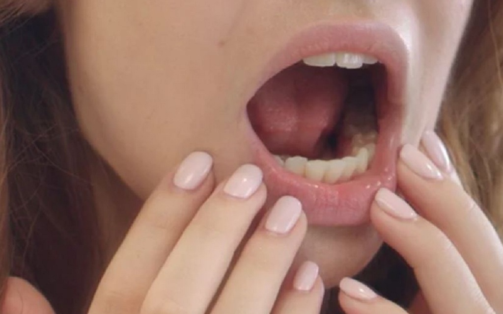 Phân biệt nhiệt miệng và ung thư lưỡi: Cách nhận biết sớm căn bệnh nguy hiểm- Ảnh 2.