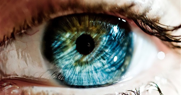 5 biến chứng nguy hiểm của viêm mống mắt có thể gây mất thị lực