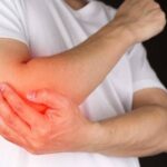 Đau nhức khuỷu tay cảnh báo những bệnh lý nào?