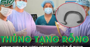 Người đàn ông thủng tạng rỗng do con lươn dài 50cm chui vào ổ bụng