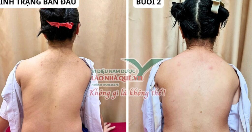 Tìm hiểu nguyên lý ‘Khai thông cột sống’ của Lão Nhà Quê