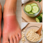 5 cách tự nhiên giúp làm dịu, cải thiện tình trạng cháy nắng ở bàn chân