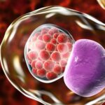 5 dấu hiệu cảnh báo nhiễm Chlamydia ở phụ nữ: Nhận biết sớm để phòng ngừa vô sinh