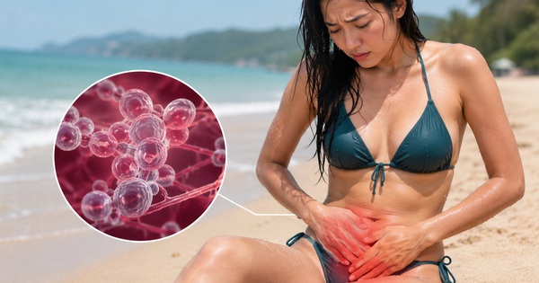 Sai lầm khi đi biển khiến viêm âm đạo do nấm tái phát nhiều lần
