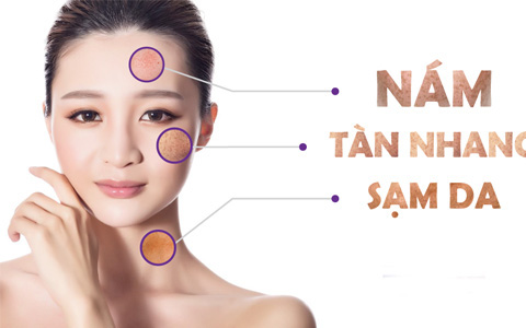 5 bài thuốc chữa sạm da