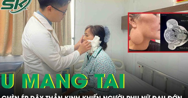 Phẫu thuật u tuyến mang tai chèn ép dây thần kinh, trả lại nụ cười cho người phụ nữ 52 tuổi