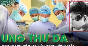 Nam thanh niên 16 tuổi ung thư da vỡ loét, gây biến dạng vùng mặt