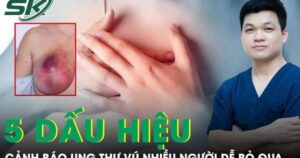 5 dấu hiệu âm thầm cảnh báo ung thư vú nhiều người dễ bỏ qua