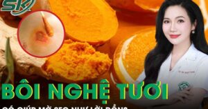 Dùng nghệ tươi bôi mặt có giúp mờ sẹo như lời đồn?