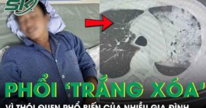 Tưởng cảm cúm, người đàn ông bất ngờ suy đa tạng, phổi ‘trắng xoá’ vì thói quen nhiều người mắc