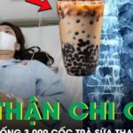 Uống 3.000 cốc trà sữa thay nước lọc suốt 9 năm, thận cô gái mọc chi chít sỏi