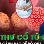 5 dấu hiệu âm thầm cảnh báo ung thư cổ tử cung nhiều người bỏ qua