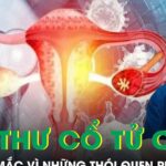Phụ nữ dễ mắc ung thư cổ tử cung vì những thói quen phổ biến này