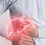 Chủ quan khi mắc xơ gan, nhiều biến chứng đe dọa tính mạng