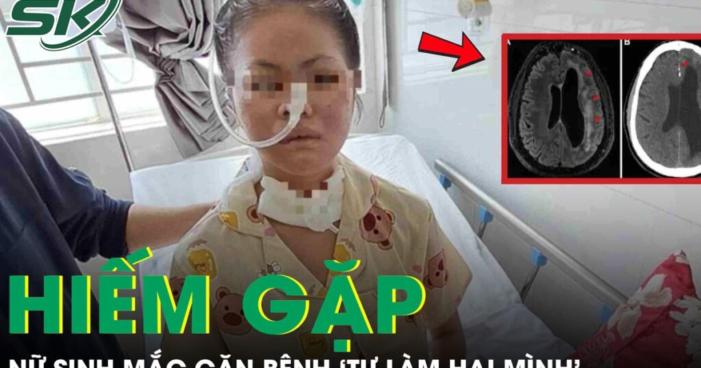 Nữ sinh 19 tuổi mắc căn bệnh ‘tự làm hại mình’ hiếm gặp